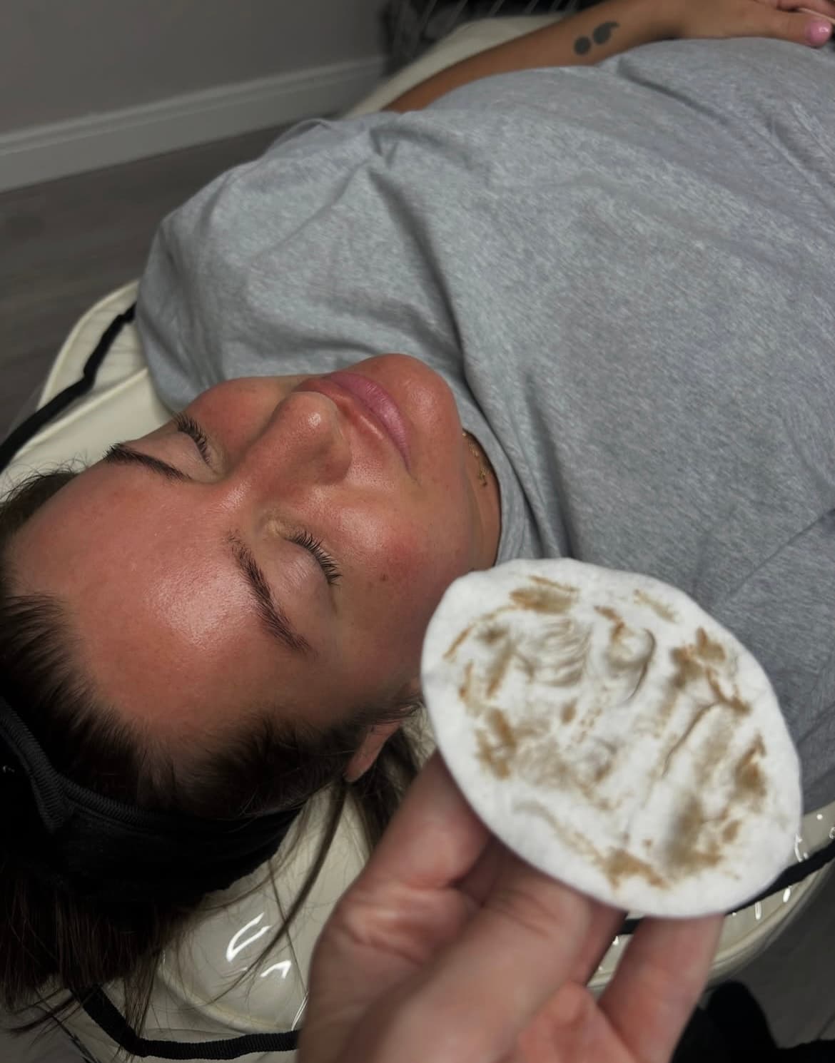 A client result photographed at Natt Aesthetics