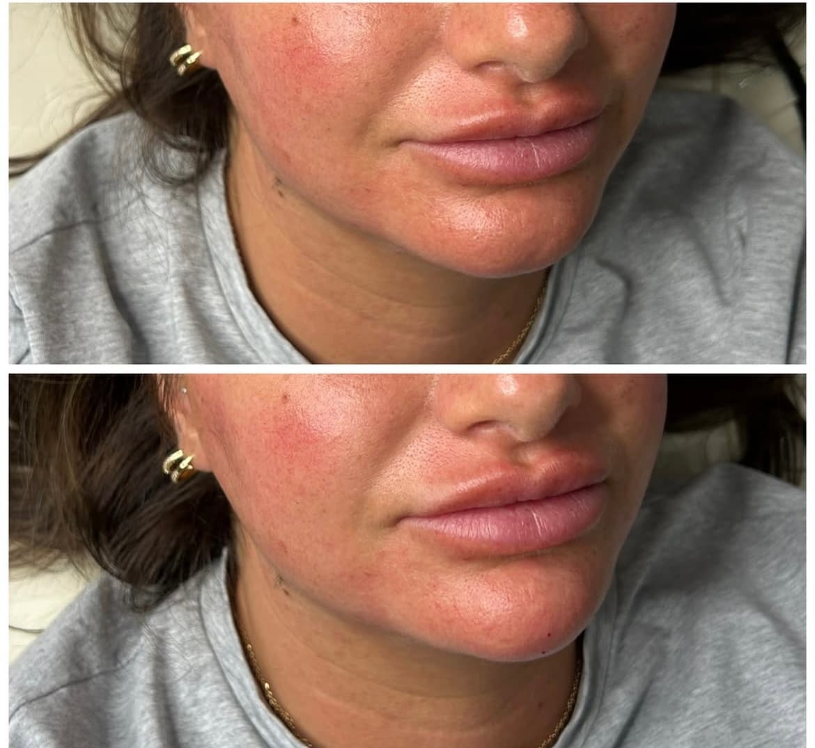 A client result photographed at Natt Aesthetics