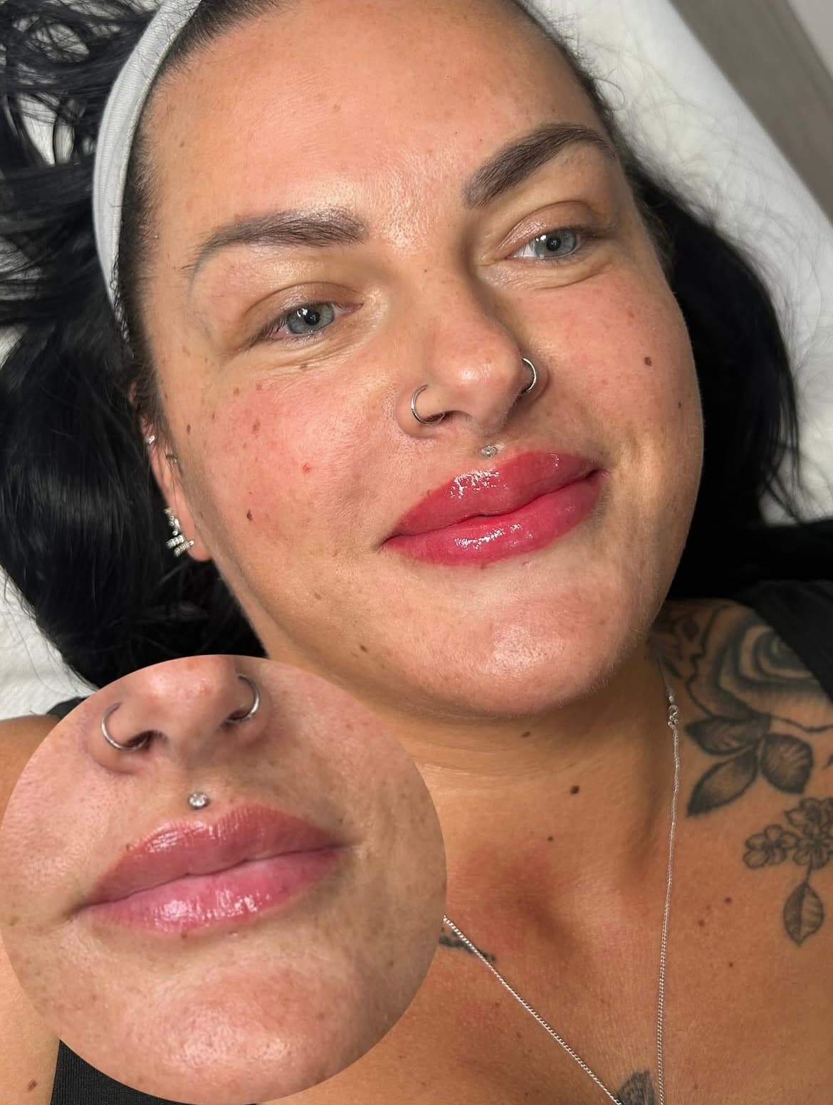 A client result photographed at Natt Aesthetics