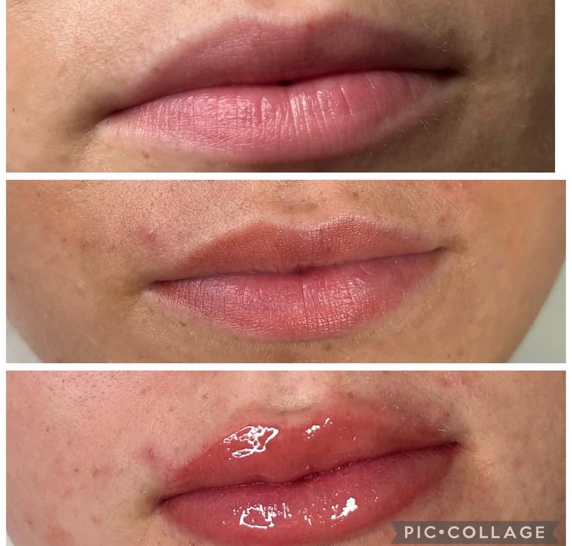 A client result photographed at Natt Aesthetics
