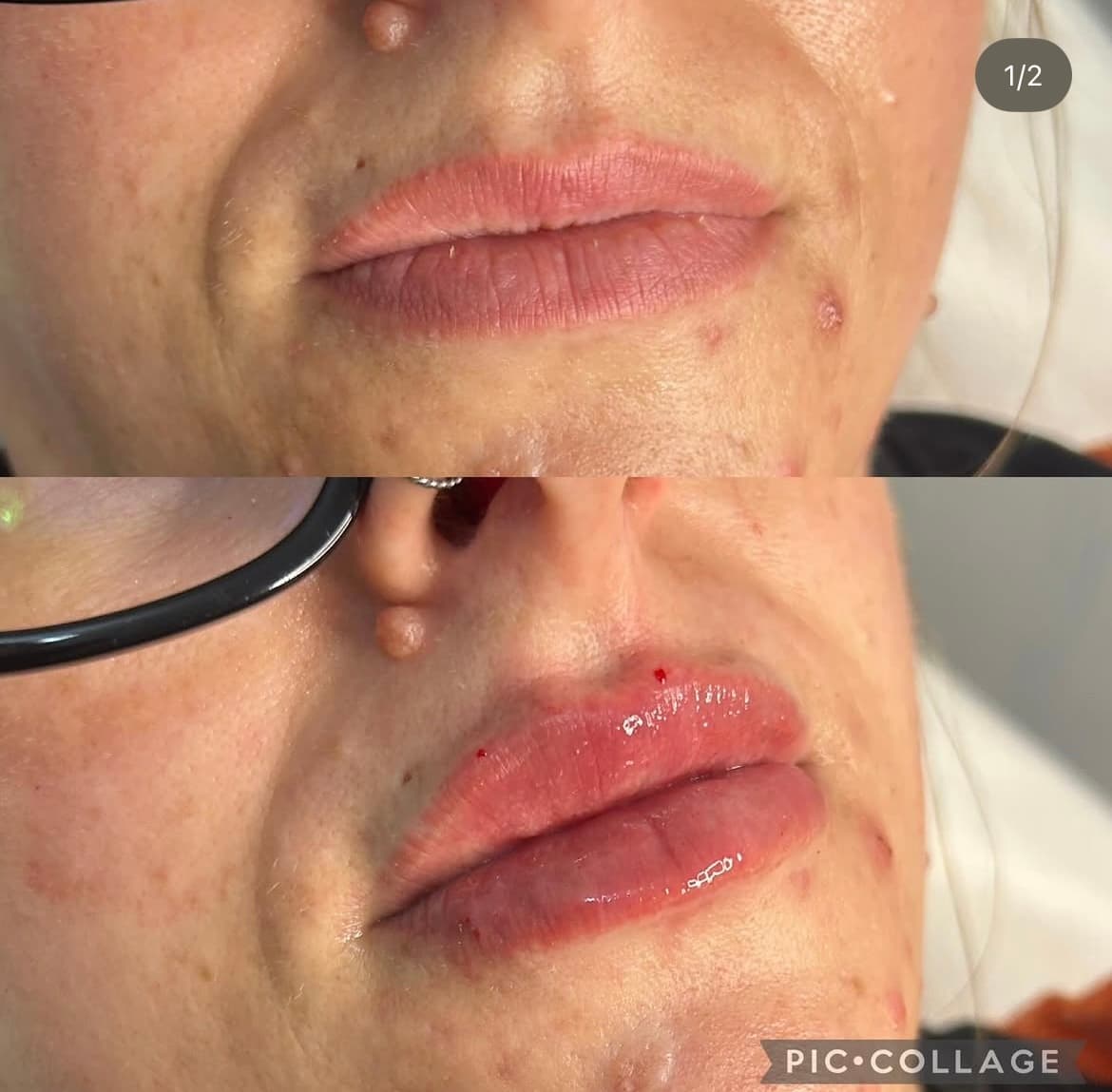 A client result at Natt Aesthetics