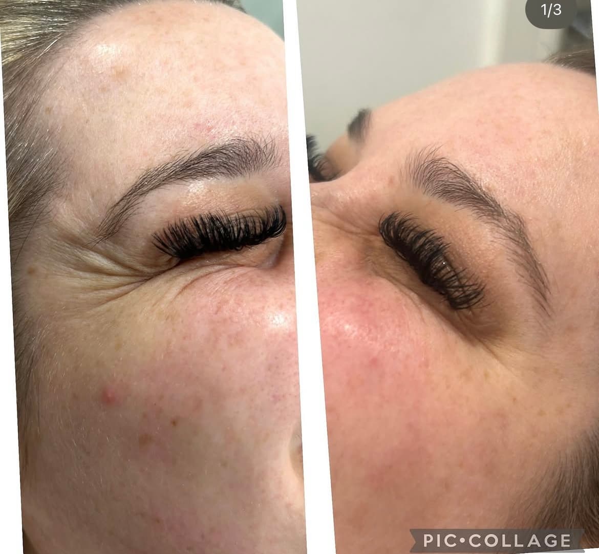 A client result at Natt Aesthetics