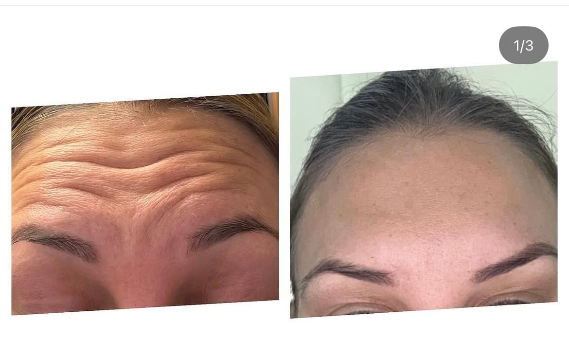 A client result at Natt Aesthetics
