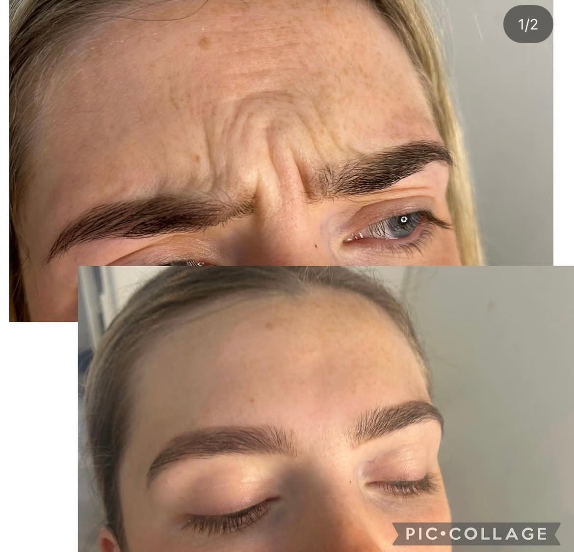 A client result at Natt Aesthetics